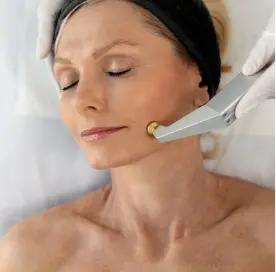 chemical_peel_melasma