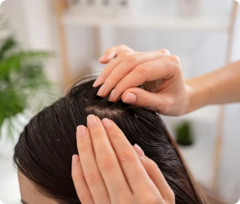 Advanced Hairfall Treatment Chennai