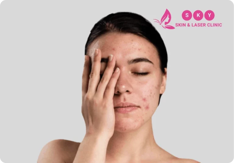 skin Care