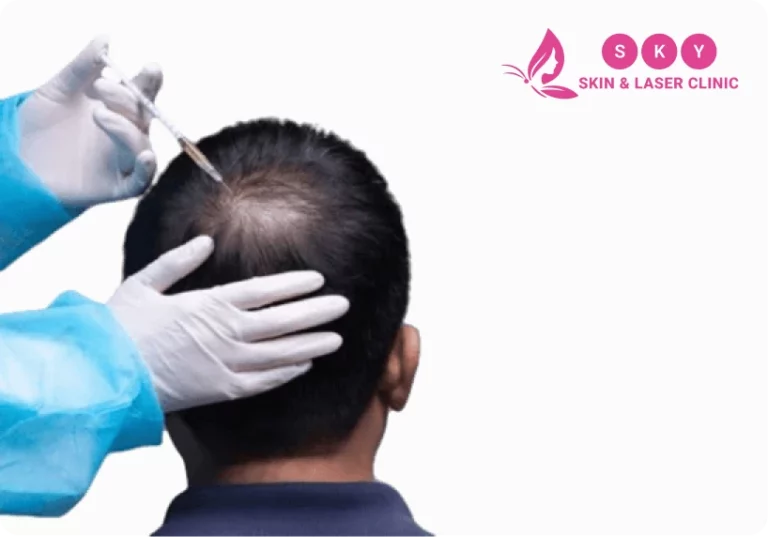 PRP Therapy