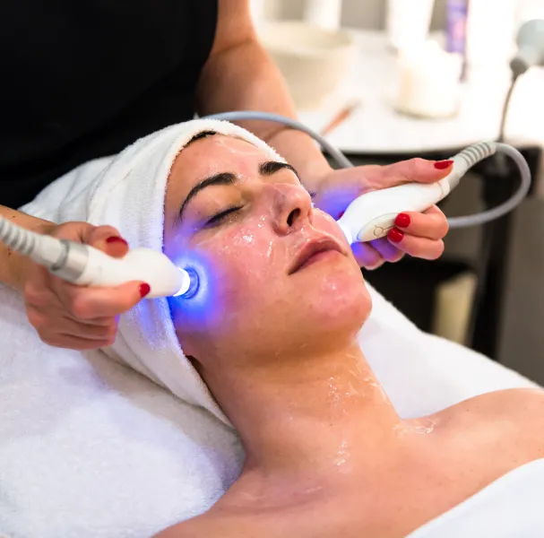 Advanced Radio Frequency Cautery Treatment in Chennai banner Image