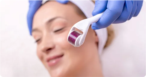 Derma_Roller_Treatment_in_Chennai