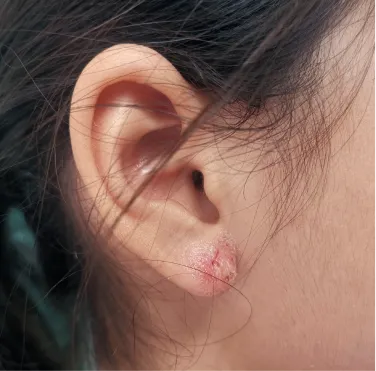 Ear & Nose Piercing