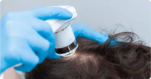 Dermatologist_for_Hair_Loss