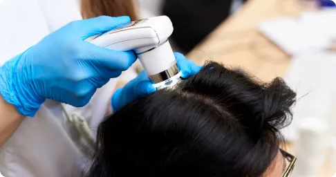 dandruff_treatment_for_scalp