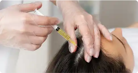 PRP_Hair_Treatment_in_Chennai