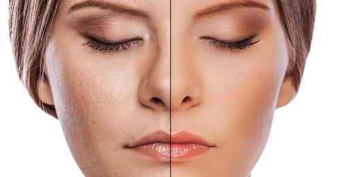 lip_pigmentation_treatment,