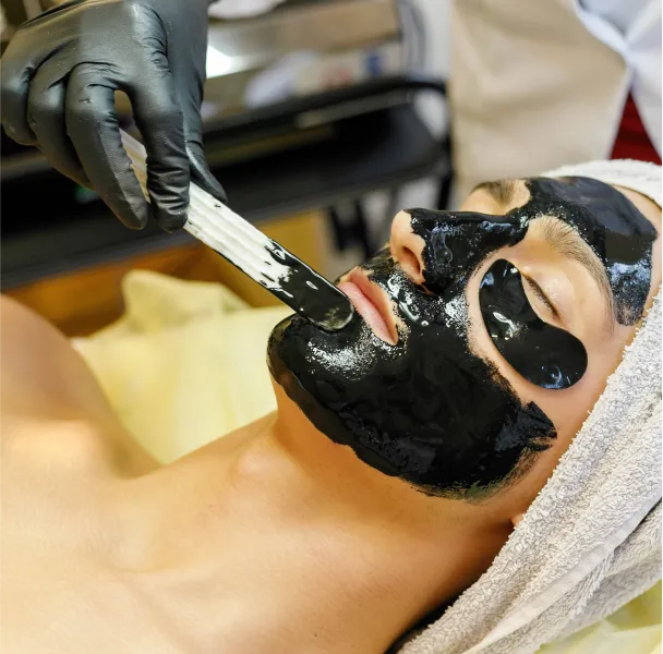 Laser_Carbon_Peel_Treatment_in_Chennai