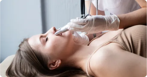 Acne & Scar Removal Treatment Chennai