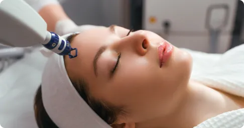 Acne & Scar Removal Treatment Chennai
