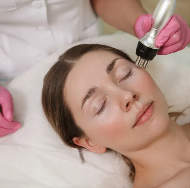 Radio Frequency Microneedling Treatment in Chennai