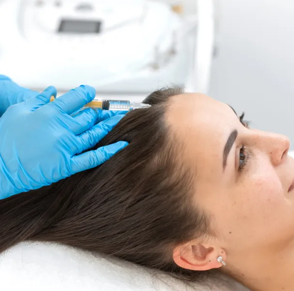 PRP_Hair_Treatment_in_Chennai