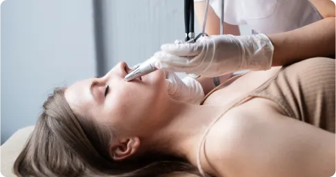 Acne & Scar Removal Treatment Chennai