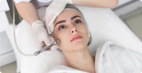 Acne & Scar Removal Treatment Chennai