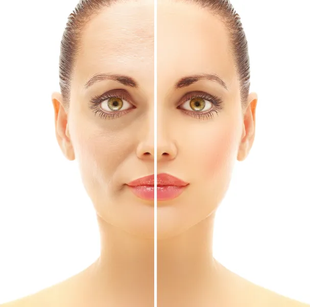 See Real Botox Results – Before & After Transformations