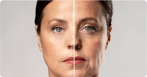 Best_Anti_Aging_Treatment_in_Chennai