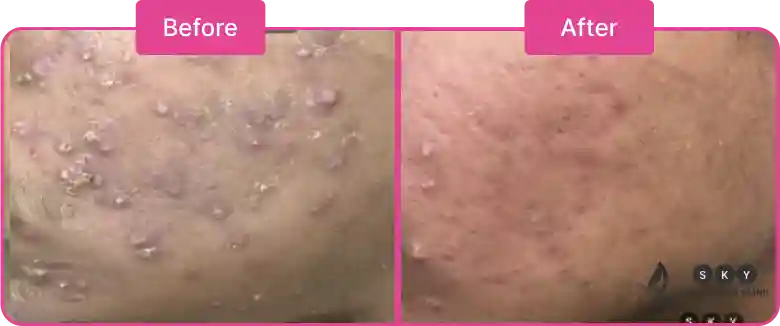 before_after_images_section