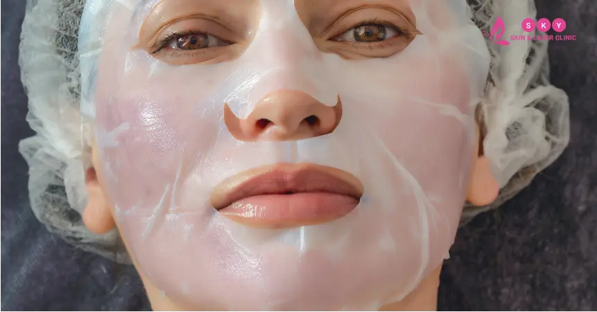 bridal_chemical_peel