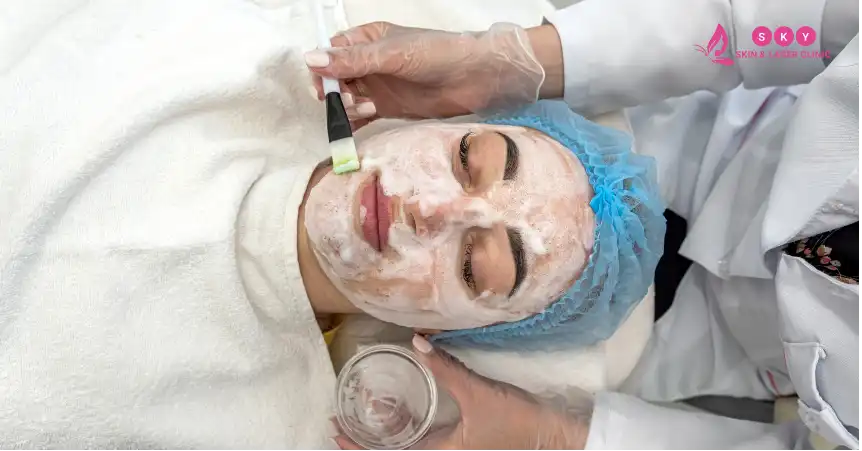 chemical_peel_facial