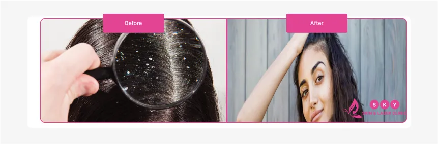 effective_hairfall_and_dandruff_treatments