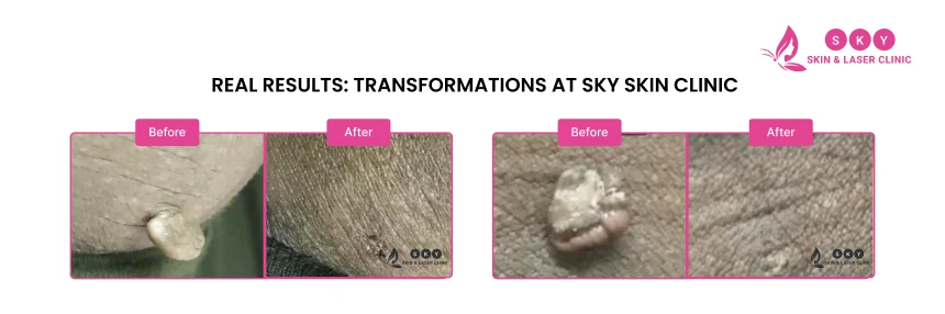 Before_and_After_for_Top-rated_Women_Dermatologists_in_Chennai