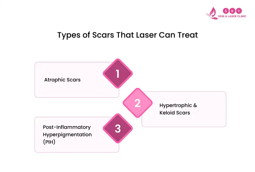 types_of_scar_that_laser_can_treat