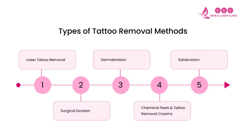 types_of_tattoo_removal_method