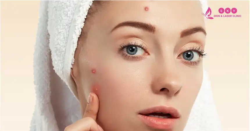understanding_pipmle_and_acne