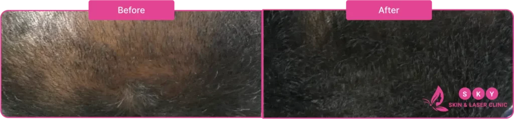 before_after_GFC_hair