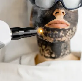 chemical_peel_melasma