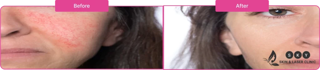 co2_before_after_image