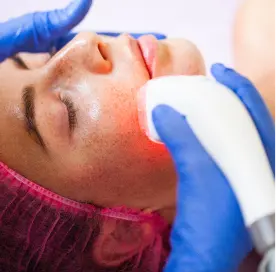 laser_treatment_for_pigmentation