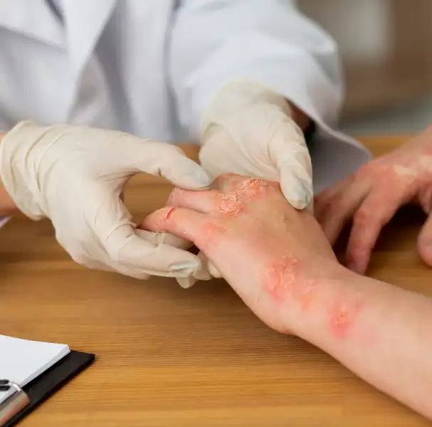 fungal_infection_treatment_banner_image