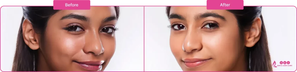 gultathione_before_after_image