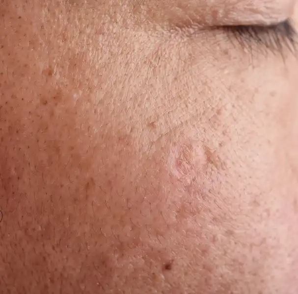 large_pores_banner_image