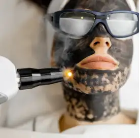 laser_treatment_for_pigmentation