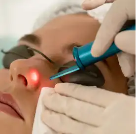 Laser treatment for open pores