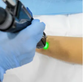 laser_vitiligo_theraphy