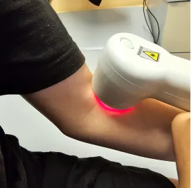 phototherapy_vitiligo