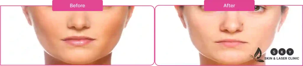 skin_tan_removal_before_and_afte